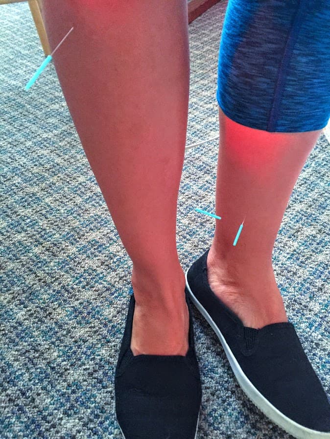 Acupuncture, gua sha, cupping, Traditional Chinese Medicine, ancestral medicine, and nutrition help regulate my nervous system and control flares.